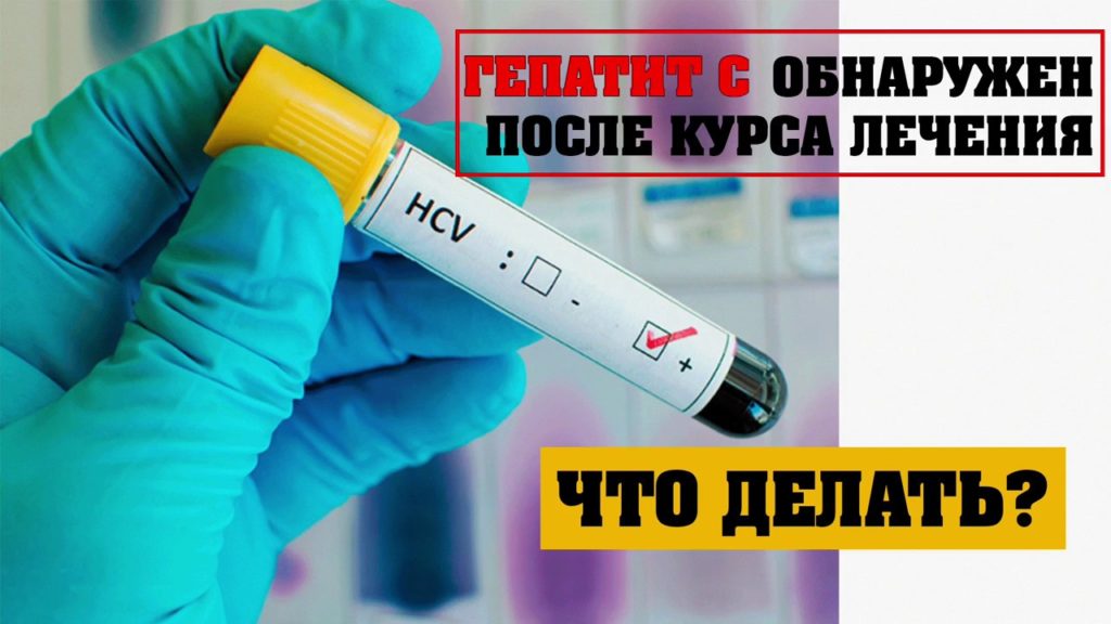 Может ли гепатит С вернуться после лечения?