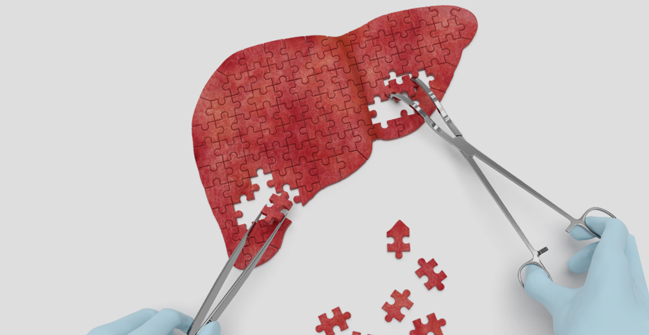 Как проходит лечение гепатита С?