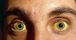 Состояние кожи при гепатите С