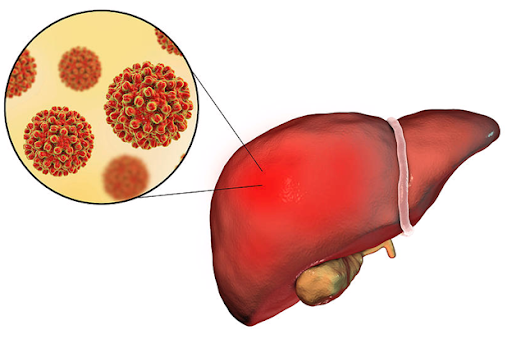 профилактика вирусного гепатита С
